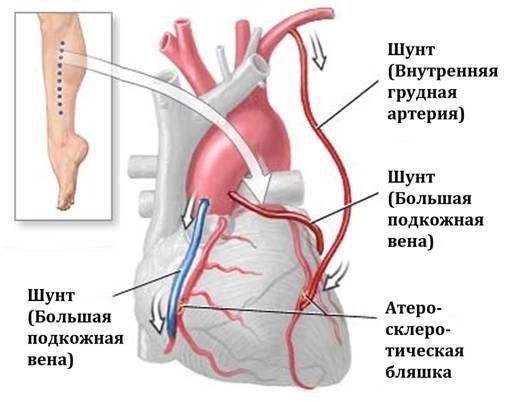 Уровни инвалидности и льготы